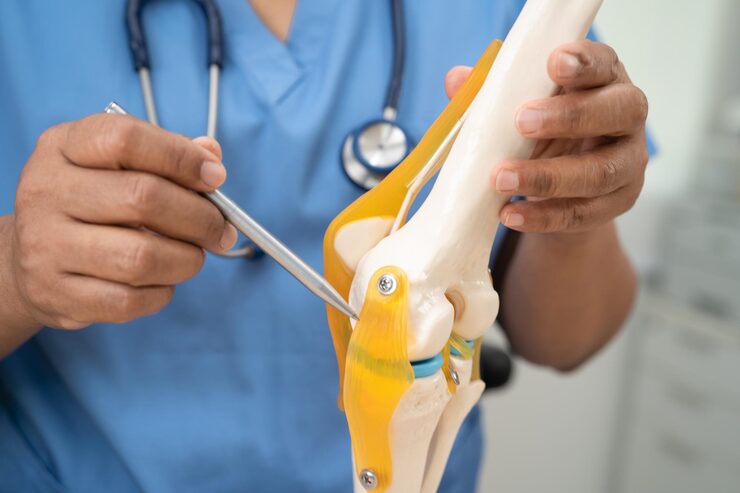 osteoarthritis knee doctor holding human knee joint orthopedic anatomy model hospital 39768 17384